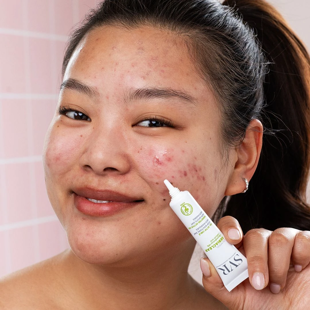 SEBIACLEAR Cicapeel - Image 2