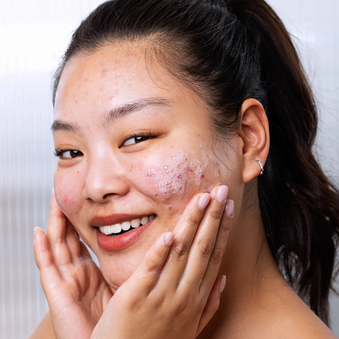 SEBIACLEAR Gel Moussant - Image 2